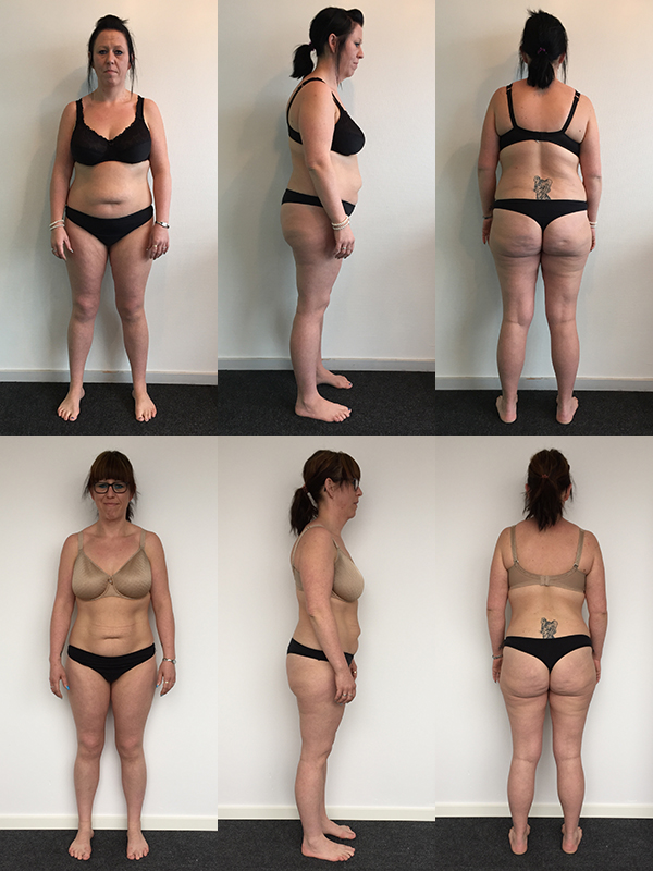 Før og efterbilleder af kvindeligt vægttab
